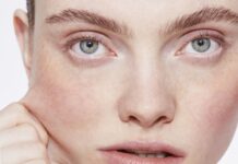 Home grown Acne Treatment – Alternative Treatments for Your Skin Alternative Treatments for Your Skin