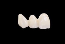 Dental Lab Houston for Complete and Partial Dentures Dental Lab