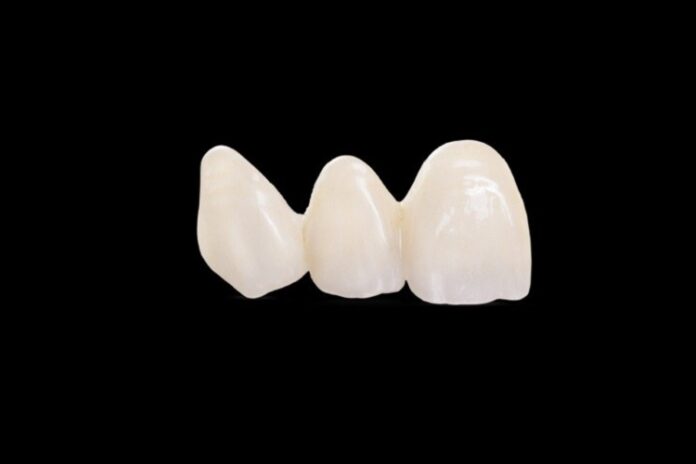 Dental Lab Dental Lab